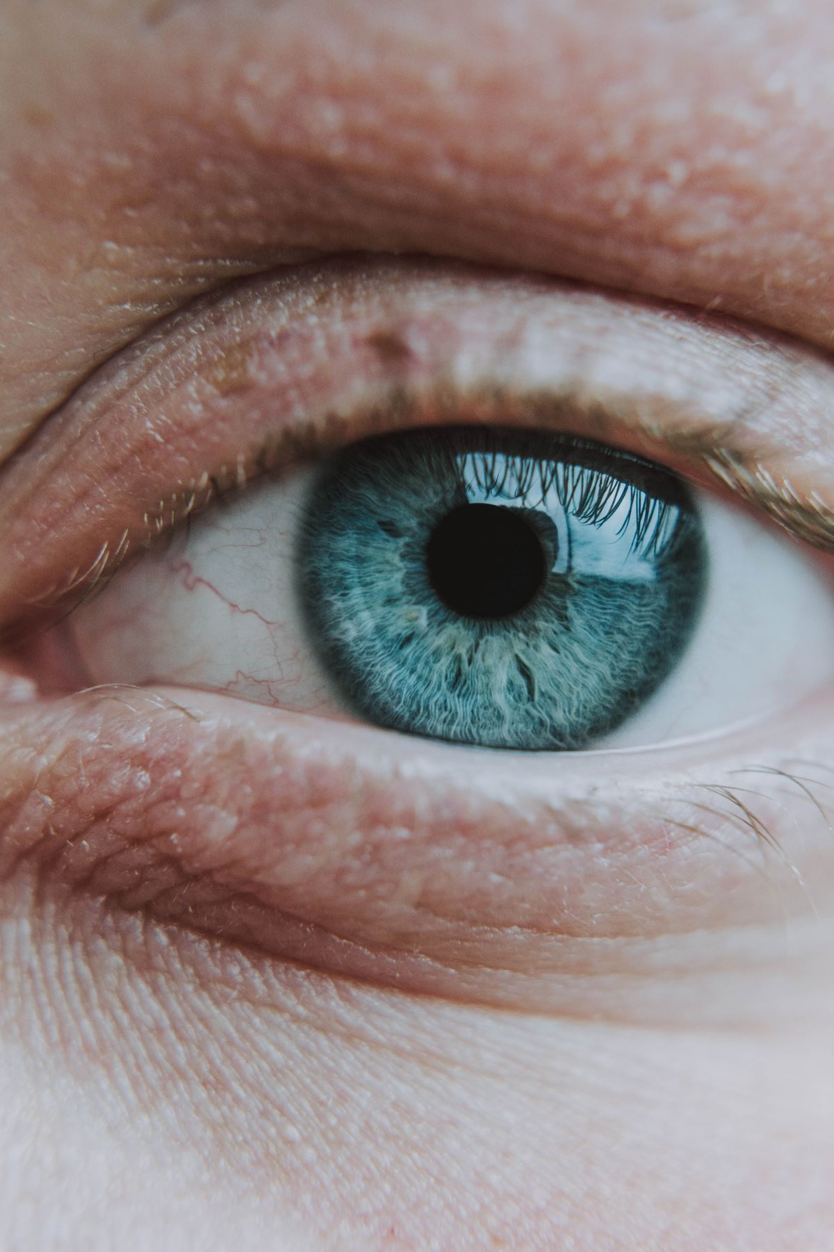 Close-up of an eye with visible blood vessels on the eyeball